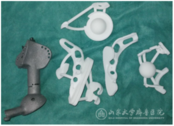 手术机器人与3D打印技术联合应用,骨肿瘤患者重燃生命希望